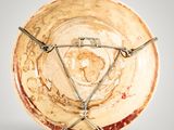 a picture of a plate with barbed wire around it