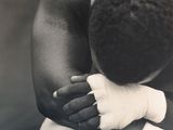 une vieille photo en noir et blanc d'un homme avec un bandage au bras
