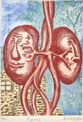 an image of a drawing of a pair of kidneys with a cityscape in the background