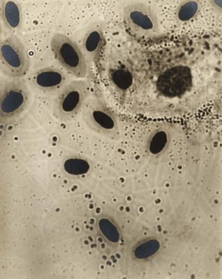 a close up of a cell phone with a lot of black dots on it