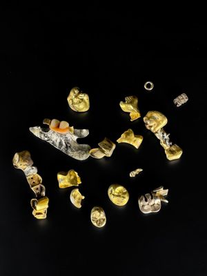 un gros plan sur un ensemble de petits objets posés sur une surface noire