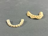 two teeth that have been placed next to each other