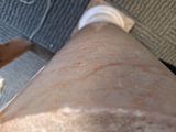 a close up view of a person ' s legs and feet with their feet on a suitcase
