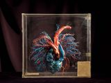 an image of a model of a human heart in a glass case