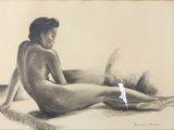 dessin représentant une femme nue assise sur un lit, avec un bandage autour de la jambe