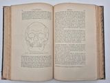 an open book with a drawing of a skull on it