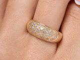 une image représentant la main d'une femme portant une bague
