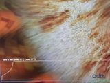 a close up of a cat ' s face with a blurry background
