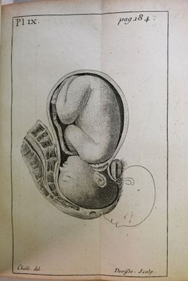 un vieux livre dans lequel se trouve le dessin d'un bébé