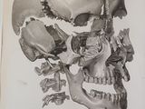 an old black and white drawing of a human skull with a broken jaw