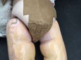 a doll that has a bandage on it ' s leg