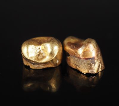 une paire de dents en or sur un fond noir