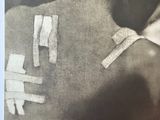 a black and white photo of a man with bandages on his back