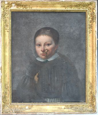 portrait d'un garçon au nez cassé et au bras déchiré