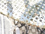 a close up of a person ' s feet on a metal table