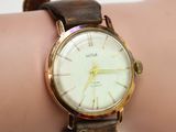 a close up of a person ' s wrist with a watch on it