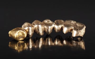 un gros plan sur une dent en or et une brosse à dents en or
