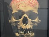 une image représentant un crâne avec un cerveau sur la tête