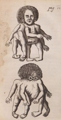 BLAES (Gerard). Observationes medicae rariores in quibus mul… - Photo 1