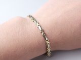 a close up of a person ' s arm with a bracelet on it