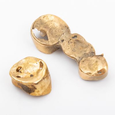 deux pièces d'or sont posées l'une à côté de l'autre sur une surface blanche